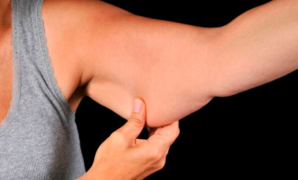 sarcopenia